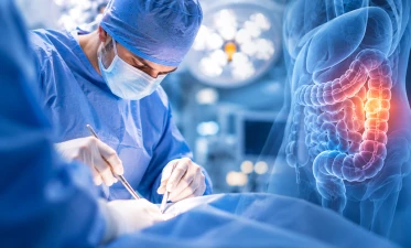 Cele mai frecvente operatii oncologice in chirurgia generala