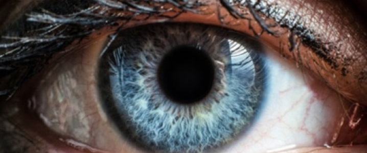 Articole/Radioterapie oftalmica