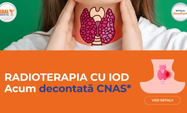 Radioterapie cu iod articol