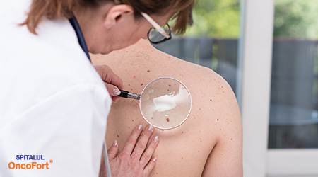 Articole/control dermatologic pentru melanom malign