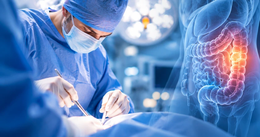 Cele mai frecvente operatii oncologice in chirurgia generala