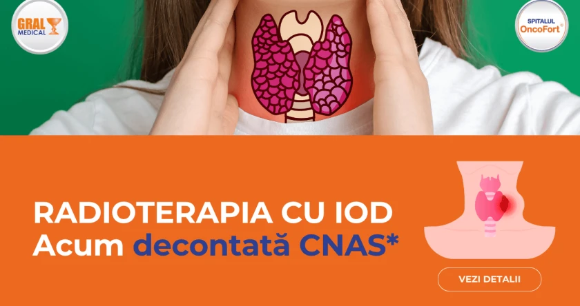Radioterapie cu iod articol