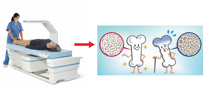 Articole/Osteodensitometrie-Scanare-DXA-Spitalul-Oncofort