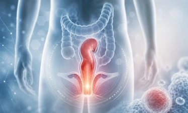 cancer anal