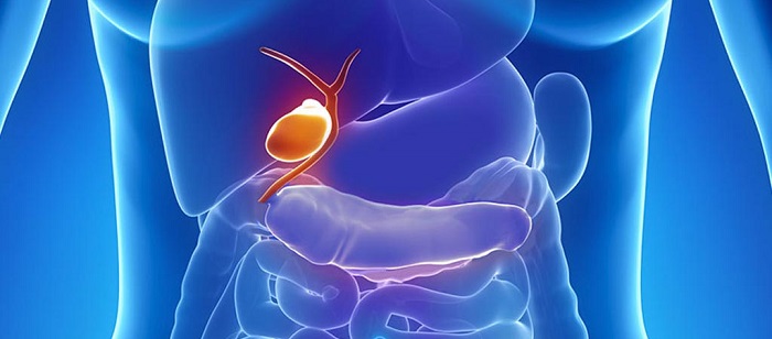 Cancer vezica biliara