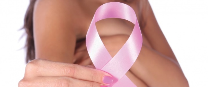 cancerul mamar oncologie